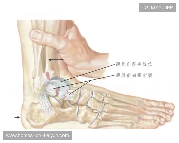 举重训练营强化伤后康复课程与随访机制，举重训练心得体会